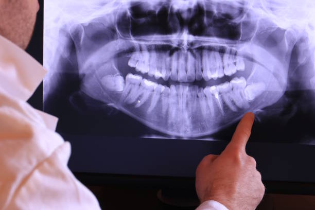 Best Emergency Root Canal Treatment in Brownsville, LA