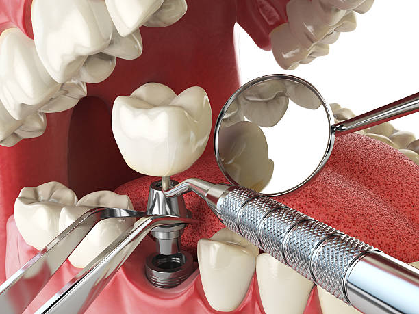 Best Same-Day Emergency Dental Services in Brownsville, LA