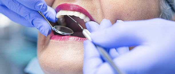 Best Emergency Dental Care for Broken or Chipped Teeth in Brownsville, LA